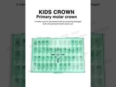 詳しく見る: KIDS CROWN 第一大臼歯歯冠